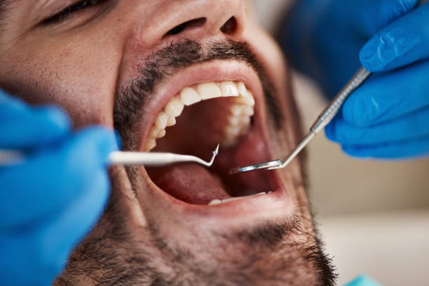 Best Emergency Gum Treatment in Hedwig Village, TX